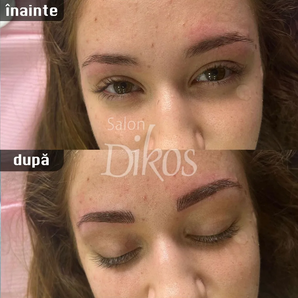 Tatuaje Sprancene - înainte și după - exemplul 8