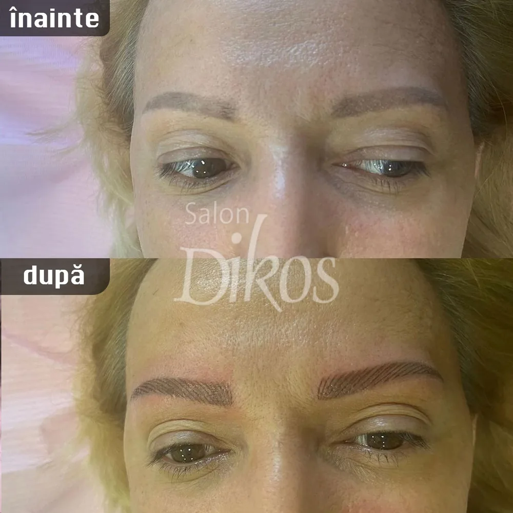 Tatuaje Sprancene - înainte și după - exemplul 11