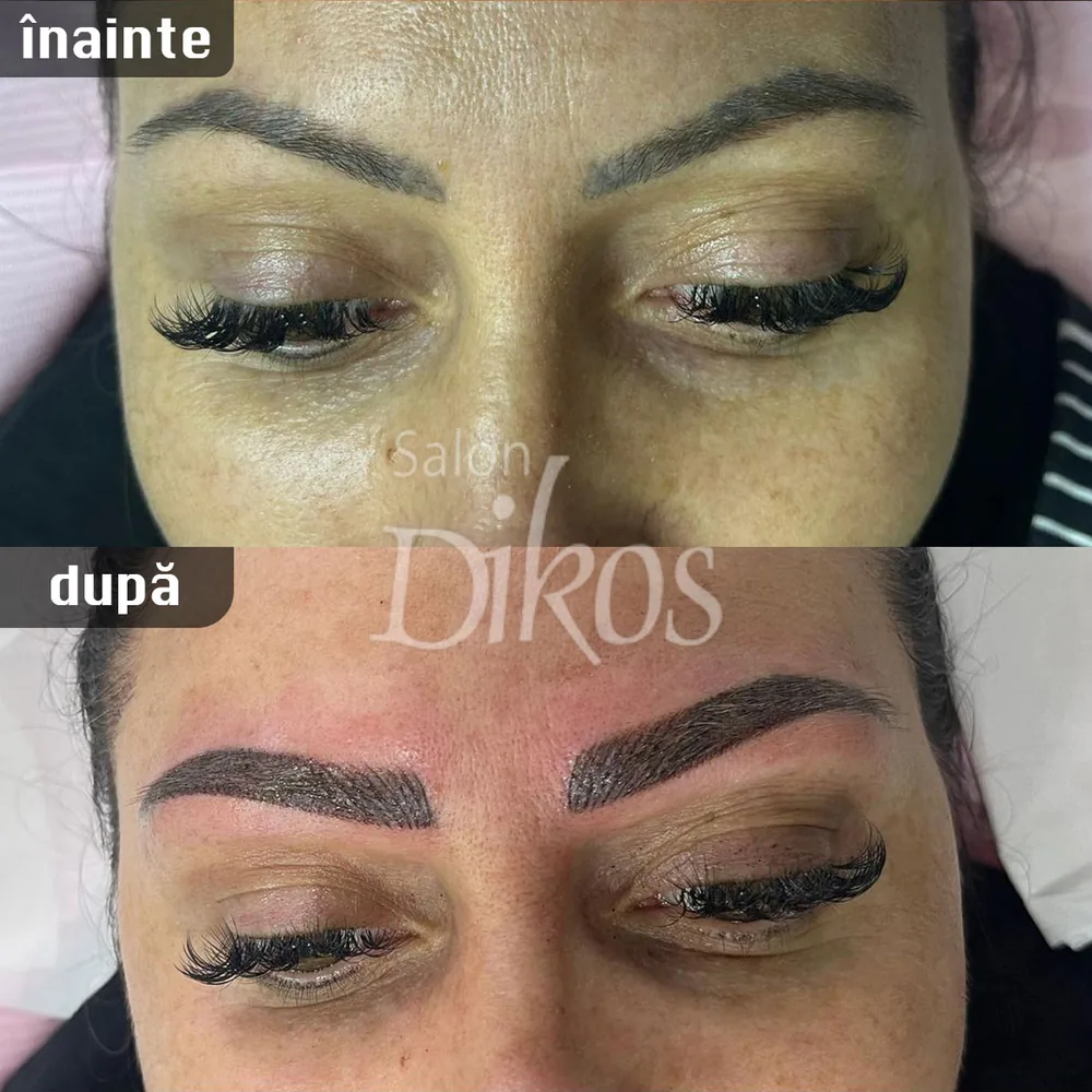 Tatuaje Sprancene - înainte și după - exemplul 31