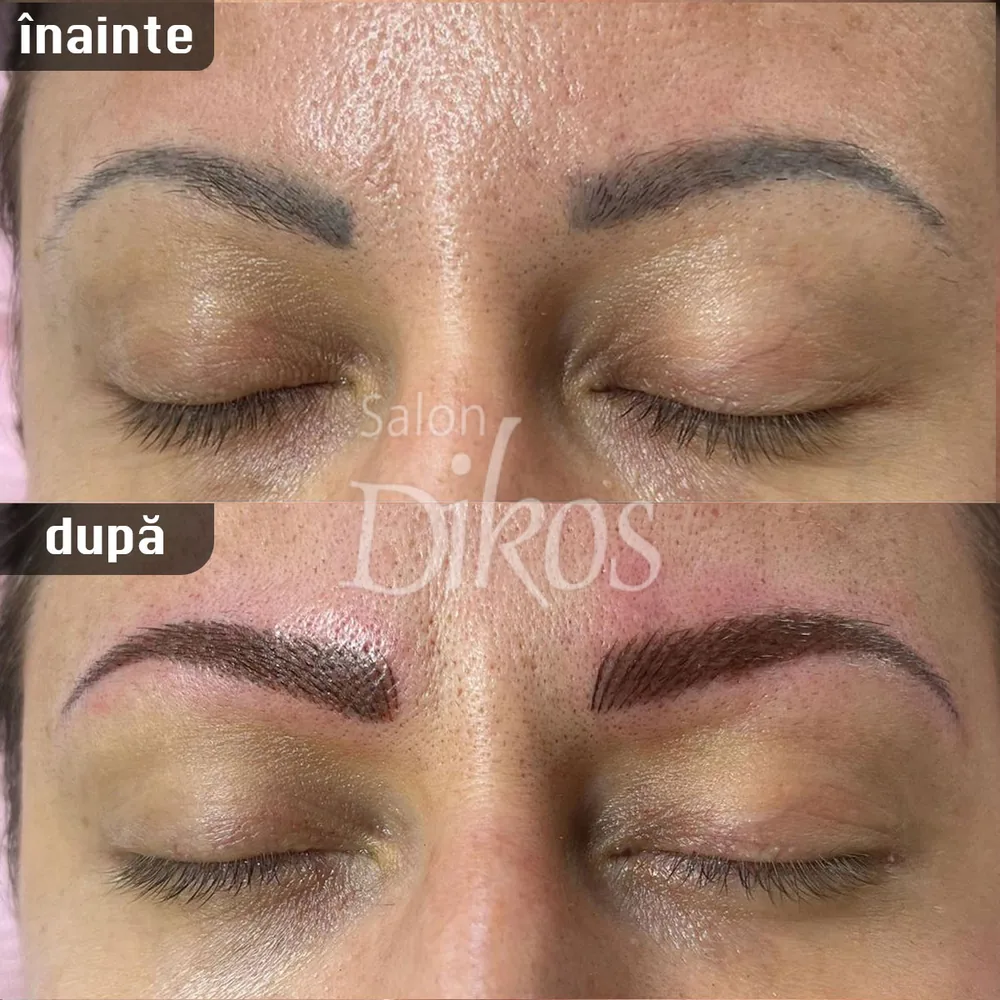 Tatuaje Sprancene - înainte și după - exemplul 18