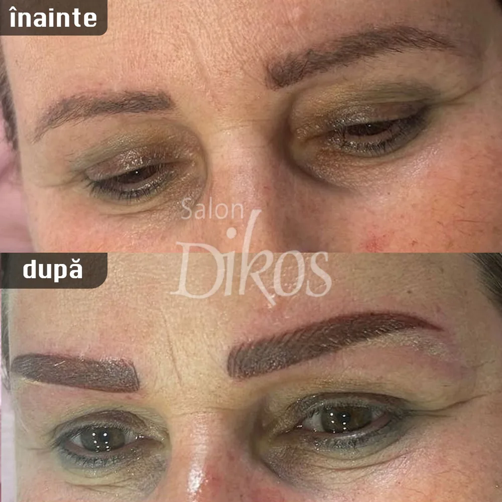 Tatuaje Sprancene - înainte și după - exemplul 13