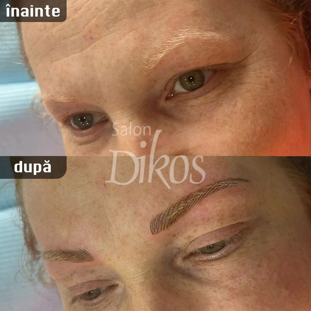 Tatuaje Sprancene - înainte și după - exemplul 21