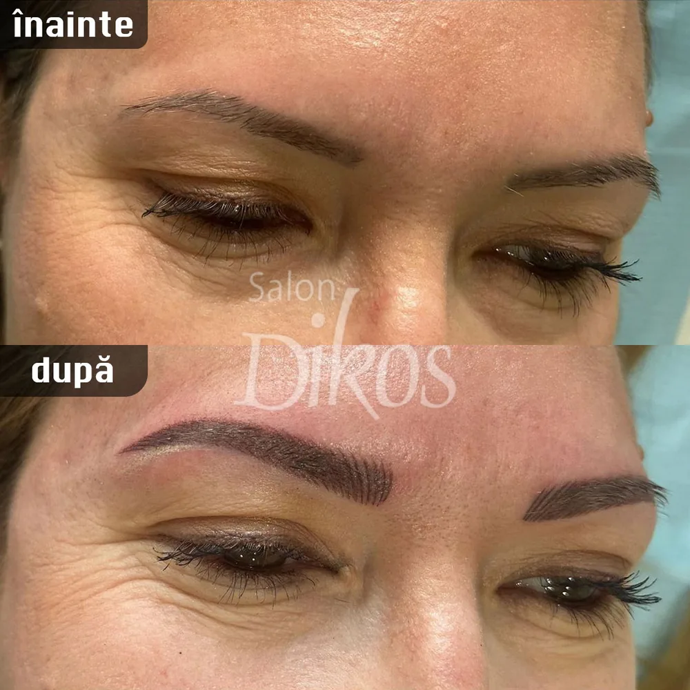 Tatuaje Sprancene - înainte și după - exemplul 28