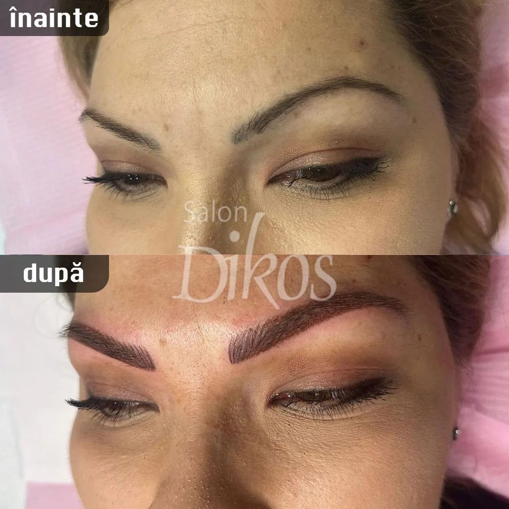 Tatuaje Sprancene - înainte și după - exemplul 3