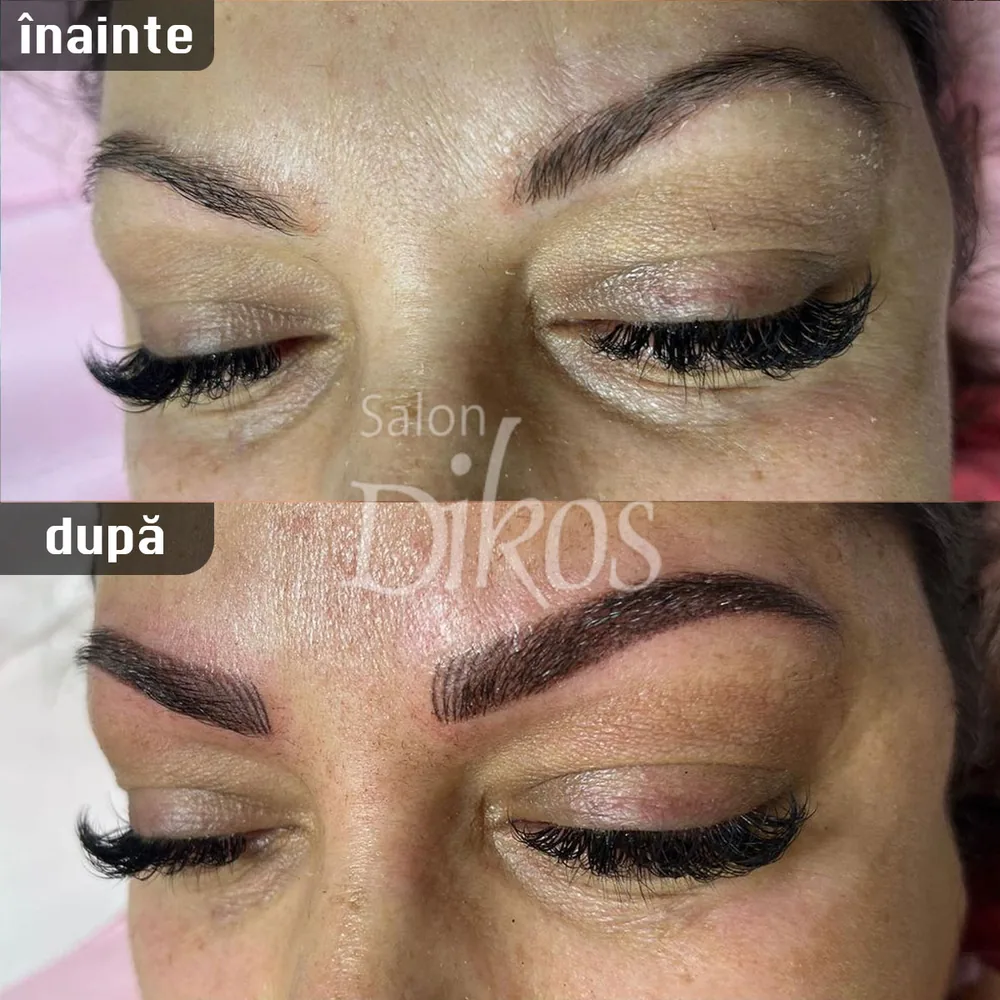 Tatuaje Sprancene - înainte și după - exemplul 19