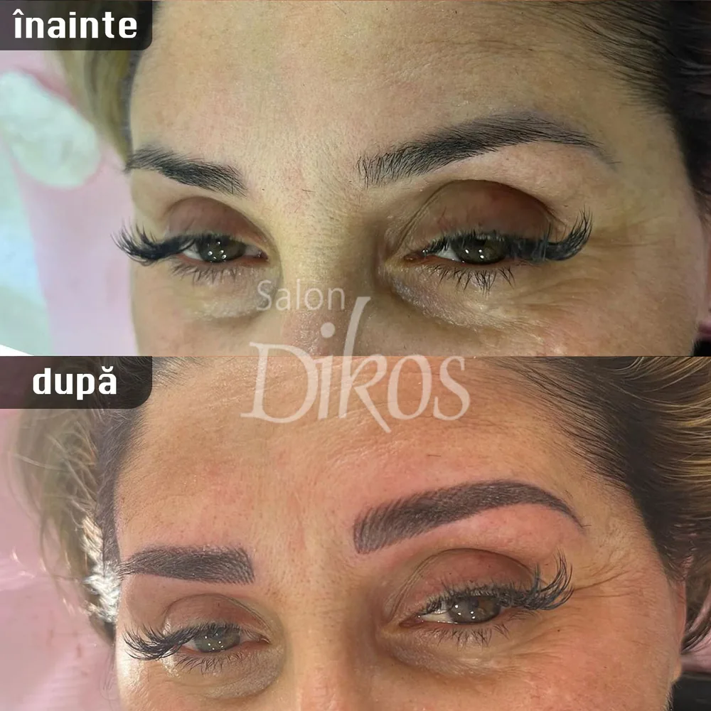 Tatuaje Sprancene - înainte și după - exemplul 29