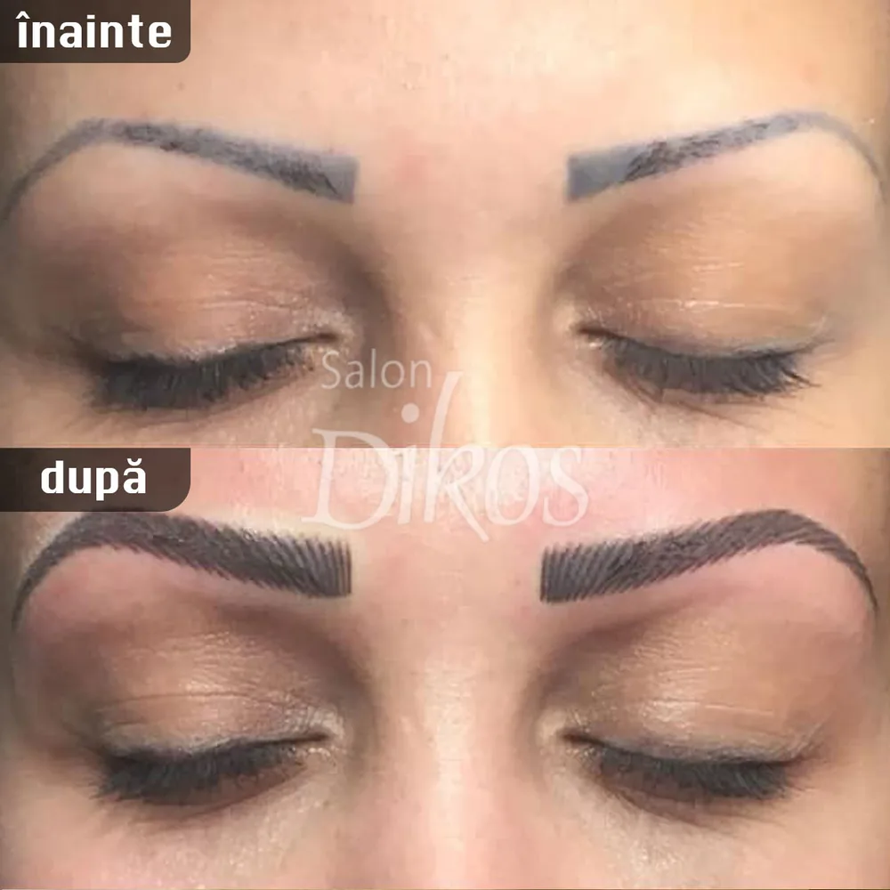 Tatuaje Sprancene - înainte și după - exemplul 16