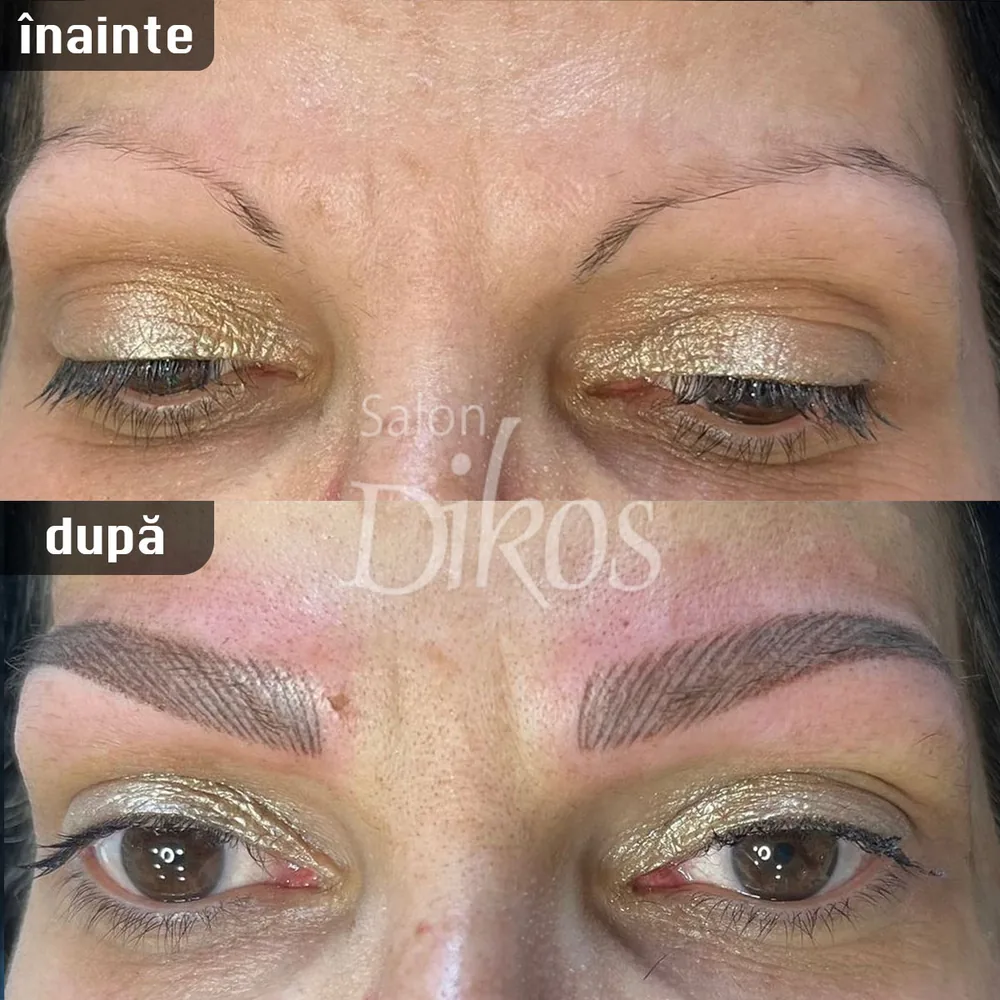 Tatuaje Sprancene - înainte și după - exemplul 36