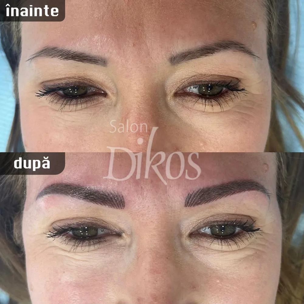 Tatuaje Sprancene - înainte și după - exemplul 14