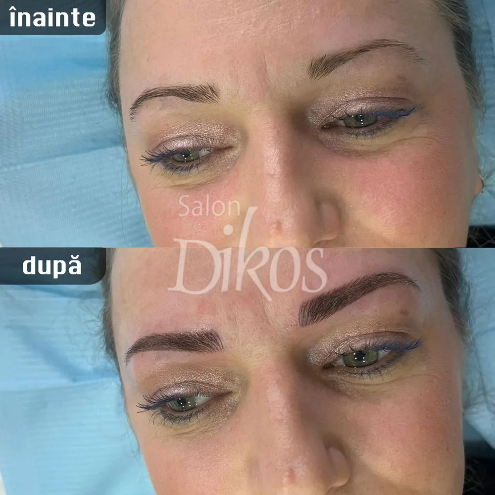 Tatuaje Sprancene - înainte și după - exemplul 4