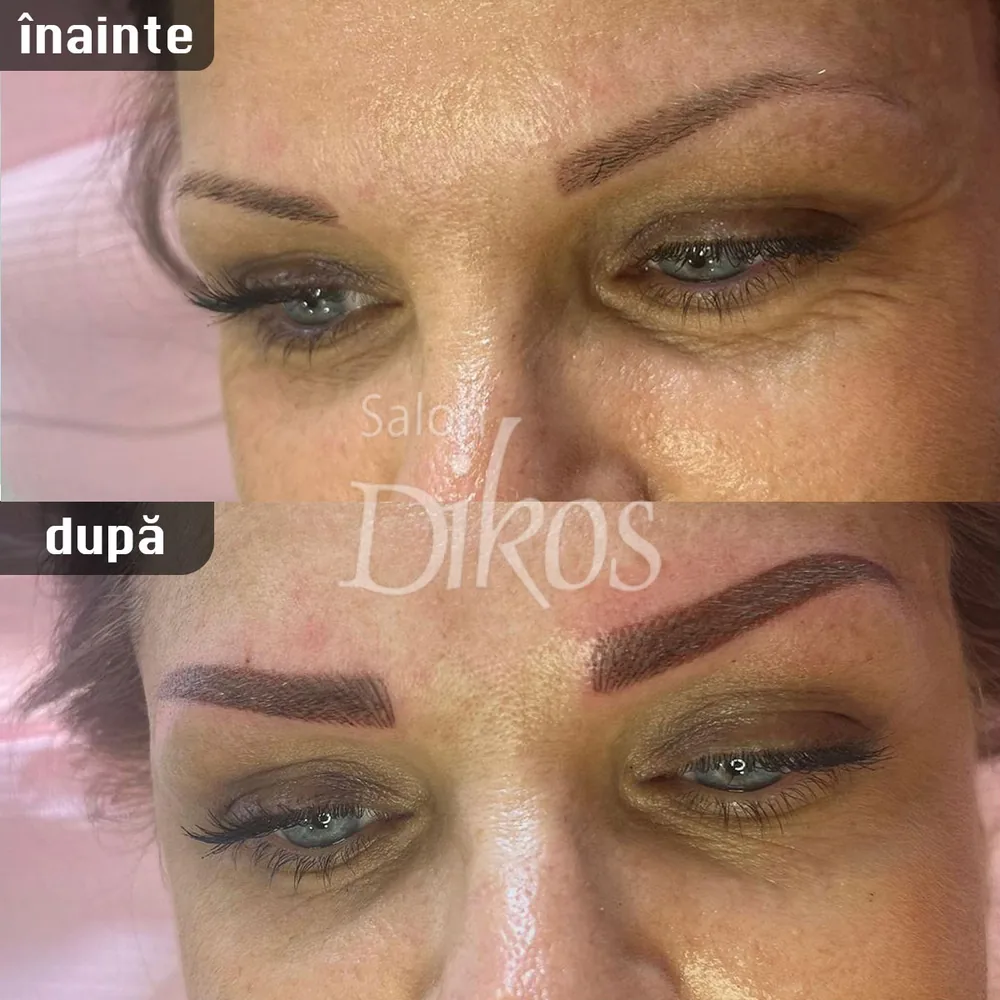 Tatuaje Sprancene - înainte și după - exemplul 6