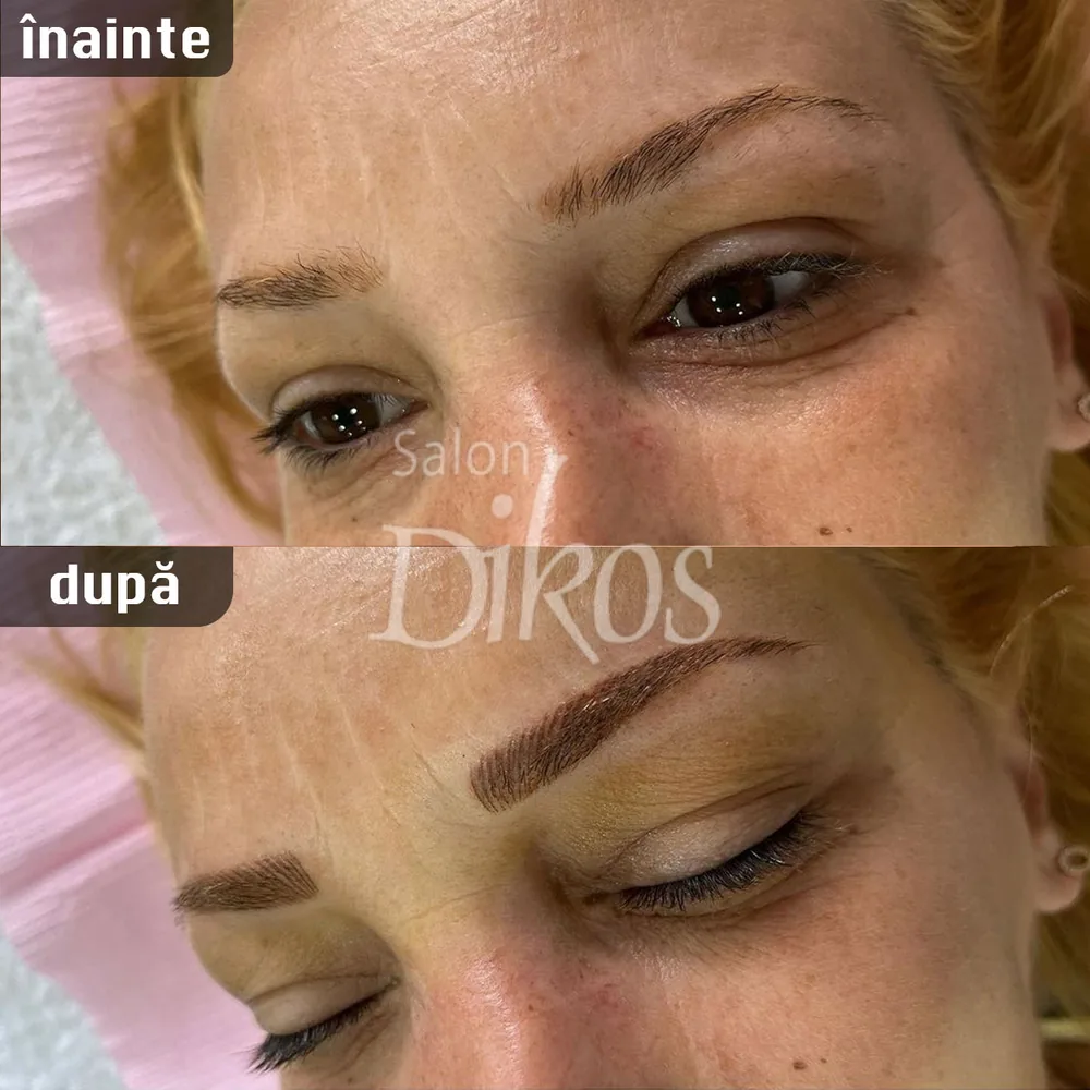 Tatuaje Sprancene - înainte și după - exemplul 24
