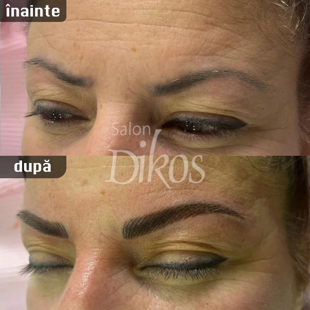Tatuaje Sprancene - înainte și după - exemplul 20