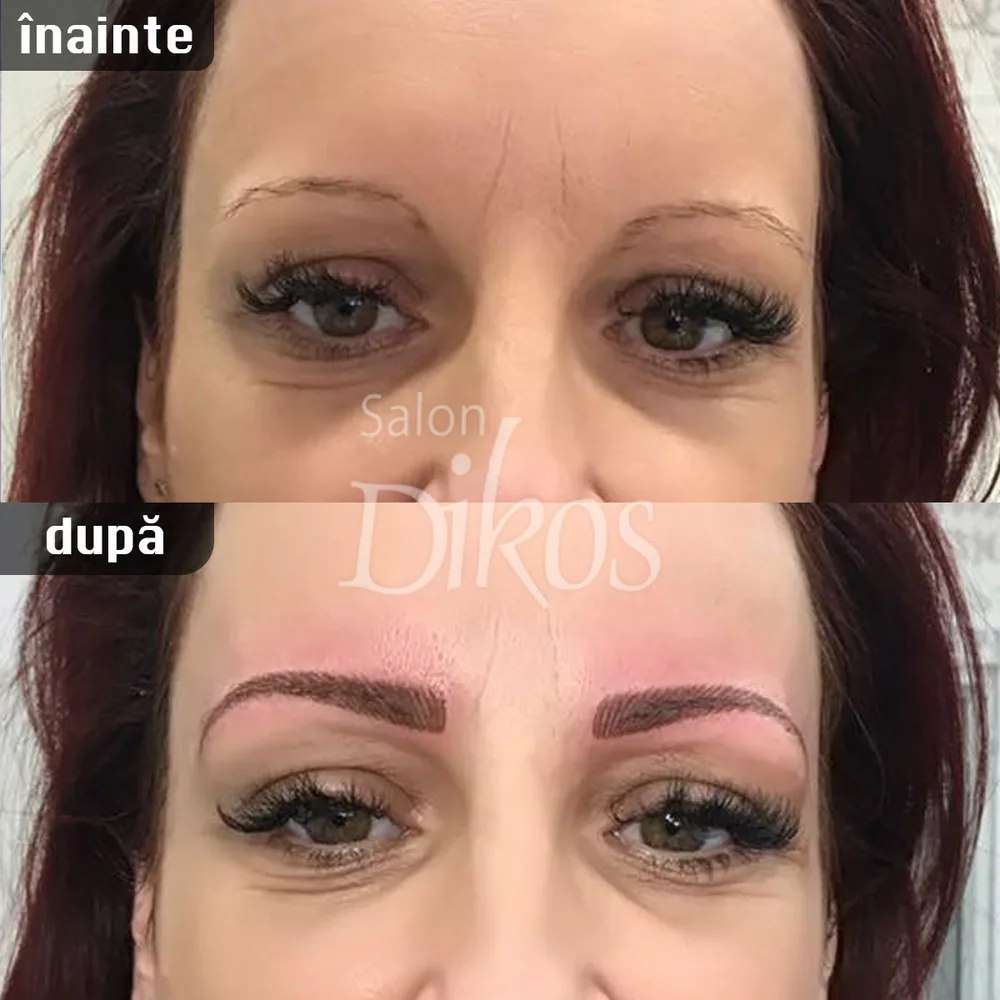 Tatuaje Sprancene - înainte și după - exemplul 10