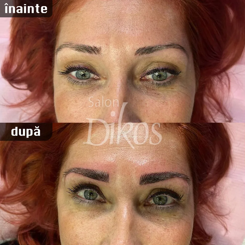 Tatuaje Sprancene - înainte și după - exemplul 1