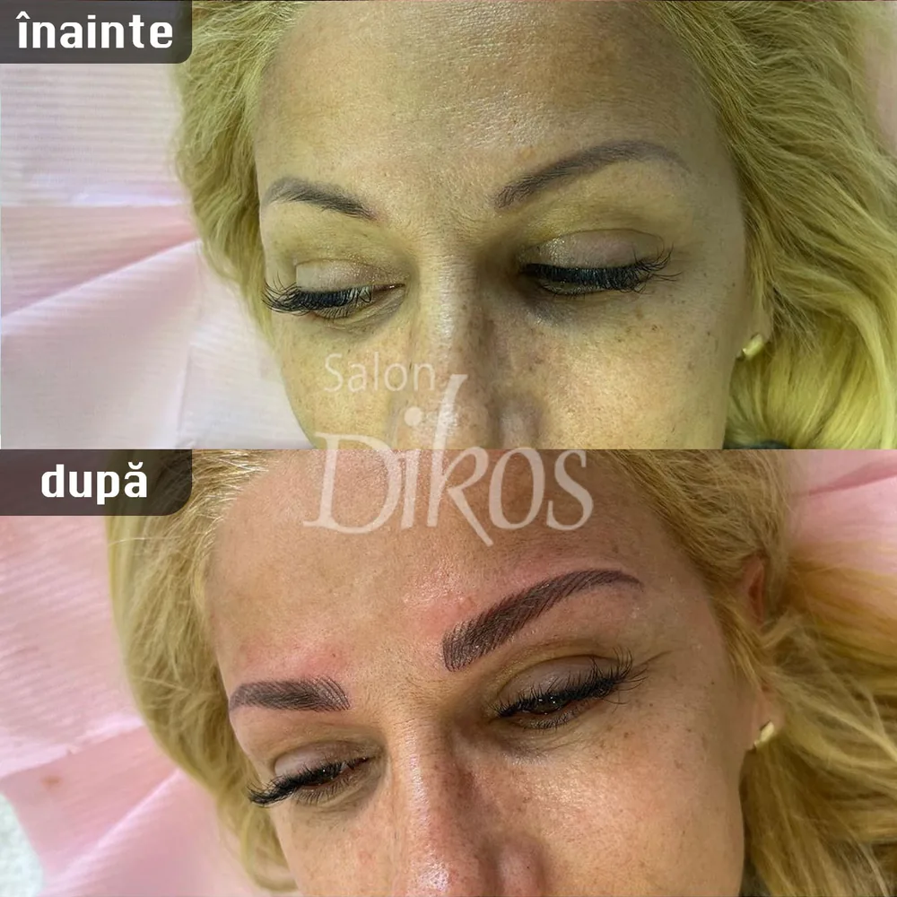 Tatuaje Sprancene - înainte și după - exemplul 26