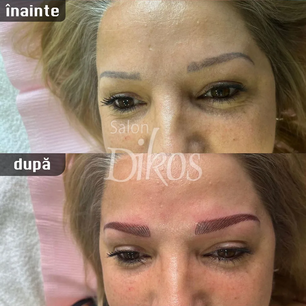 Tatuaje Sprancene - înainte și după - exemplul 2