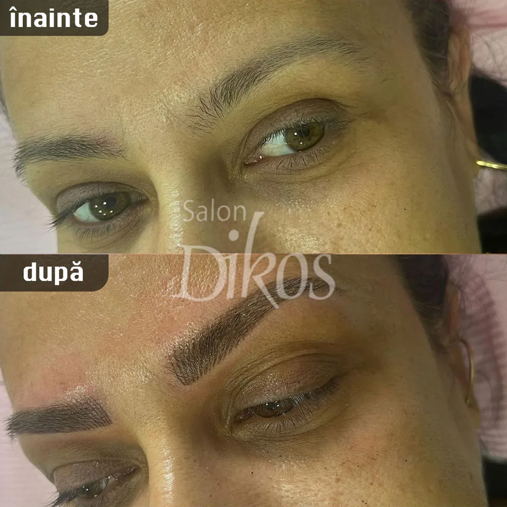 Tatuaje Sprancene - înainte și după - exemplul 25