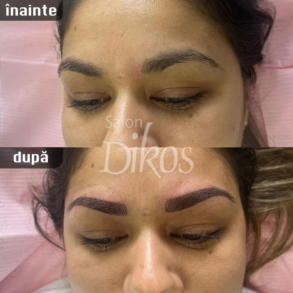 Tatuaje Sprancene - înainte și după - exemplul 9