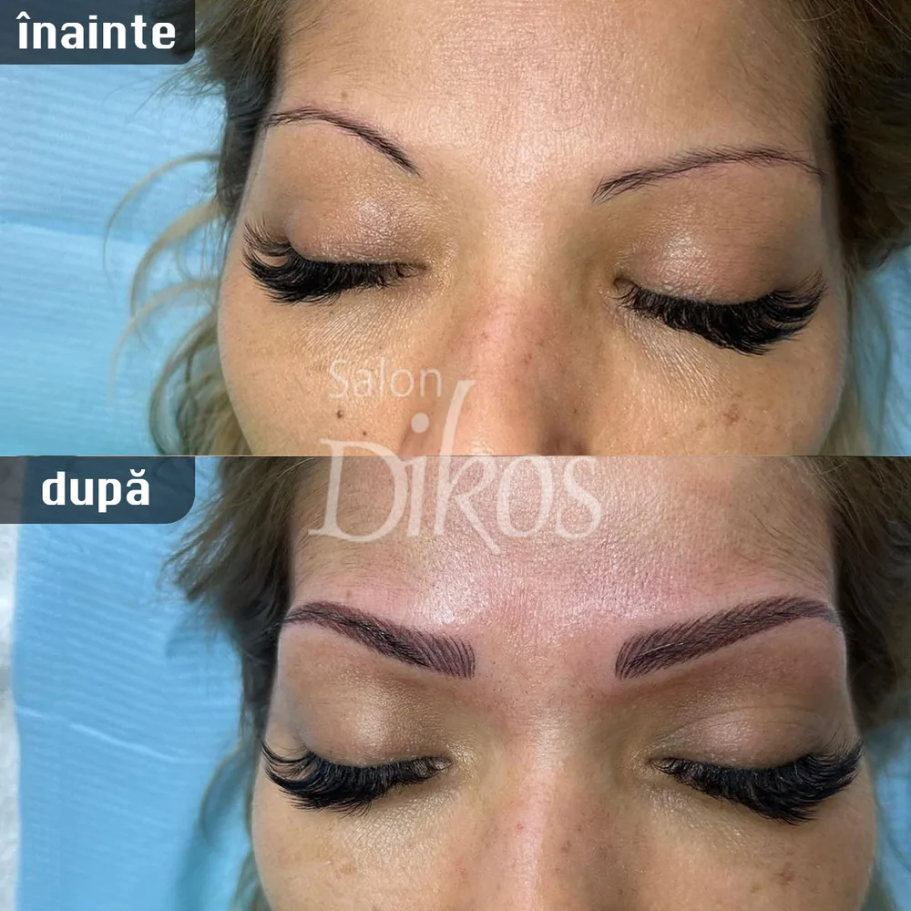 Tatuaje Sprancene - înainte și după - exemplul 35