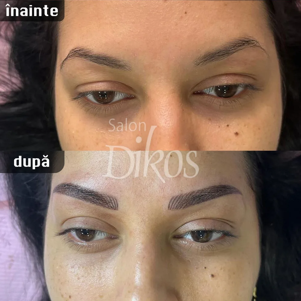 Tatuaje Sprancene - înainte și după - exemplul 15