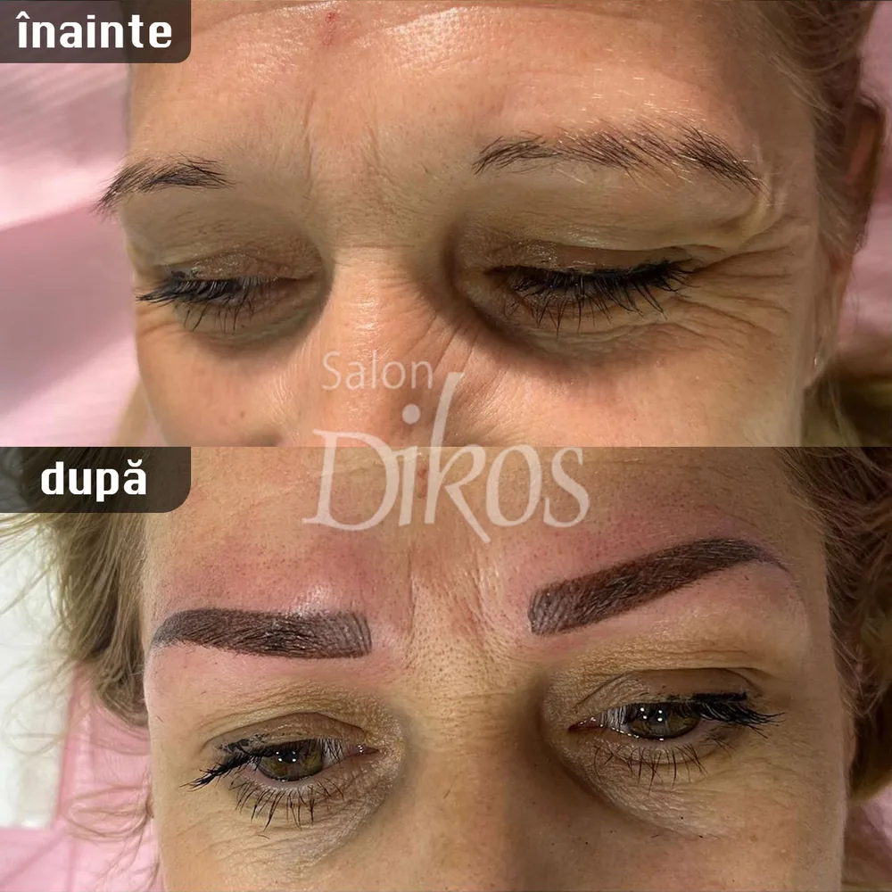 Tatuaje Sprancene - înainte și după - exemplul 30