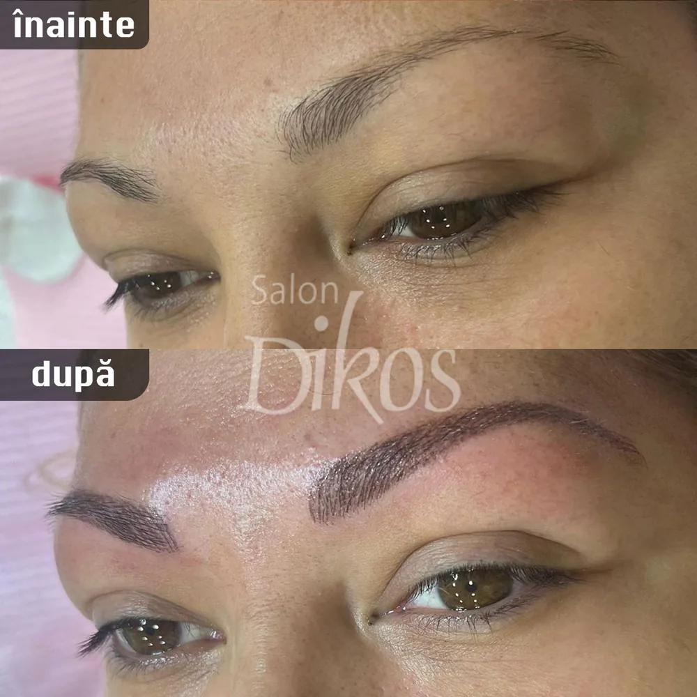 Tatuaje Sprancene - înainte și după - exemplul 5