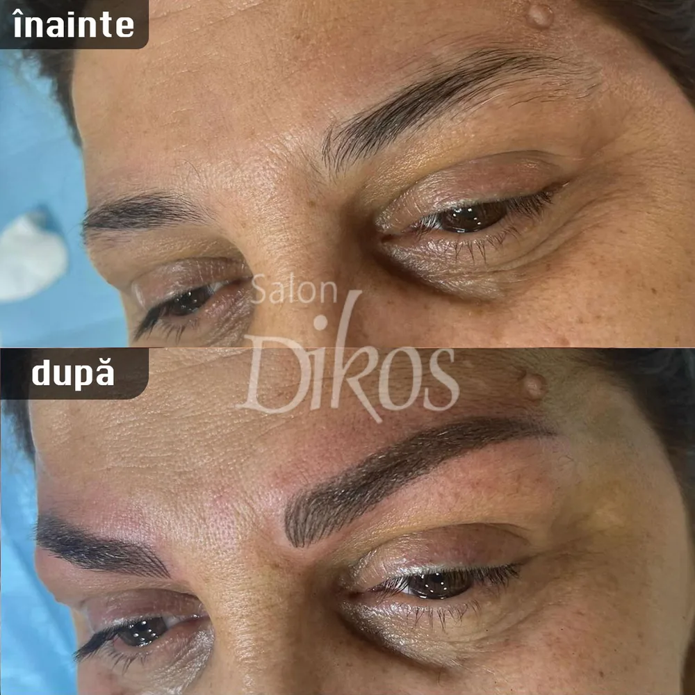 Tatuaje Sprancene - înainte și după - exemplul 33